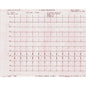 Telepaper Malaysia – ECG Paper Bionet Cardiocare 2000/3000 ( With Graph) (CSO)
