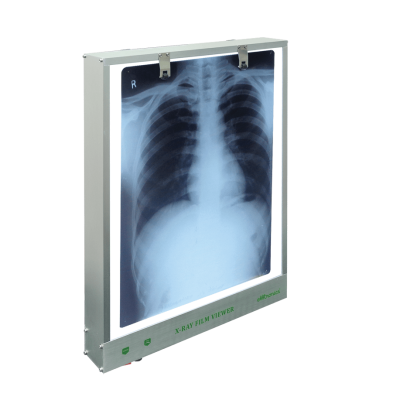 X-ray Viewer